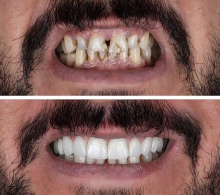 Smile Makeover Dentist in Rocklin, CA Agape Dental