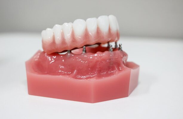 Permanent Dentures in Rocklin, CA | Book a Consultation
