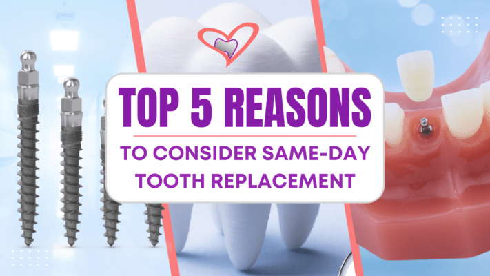 Teeth in a Day | Same-Day Dental Implants in Rocklin, CA