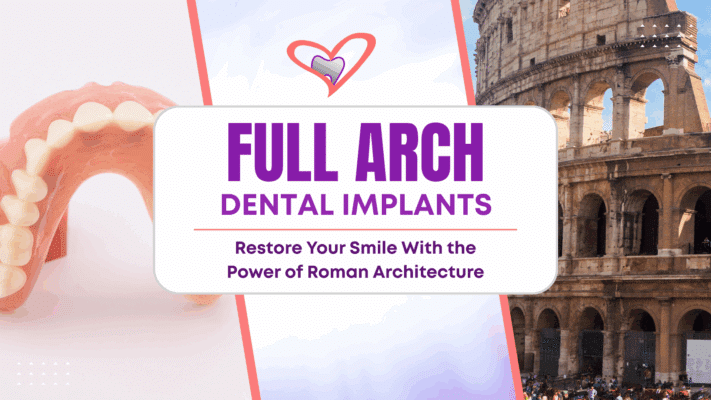 Full Arch Dental Implants in Rocklin, CA | Book a Consultation! 😁