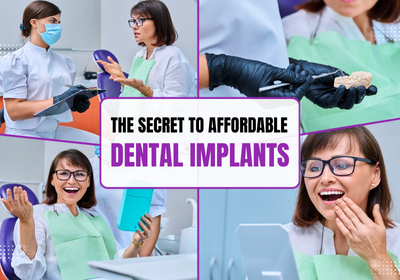 Payment Plans for Dental Implants | Dental Implants in Rocklin, CA